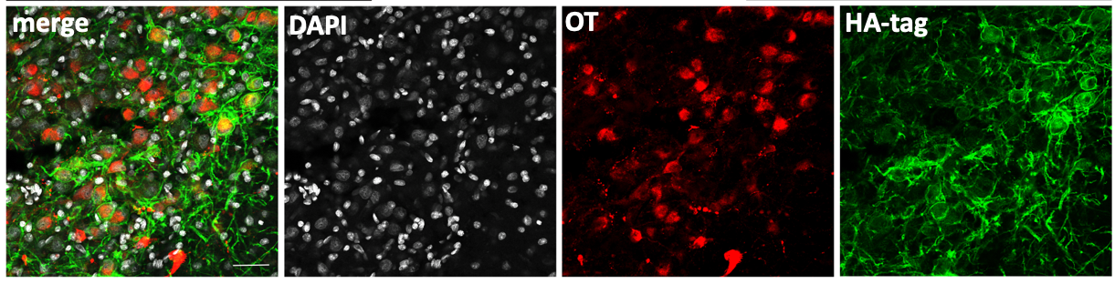 DREADD expression in oxytocin neurons