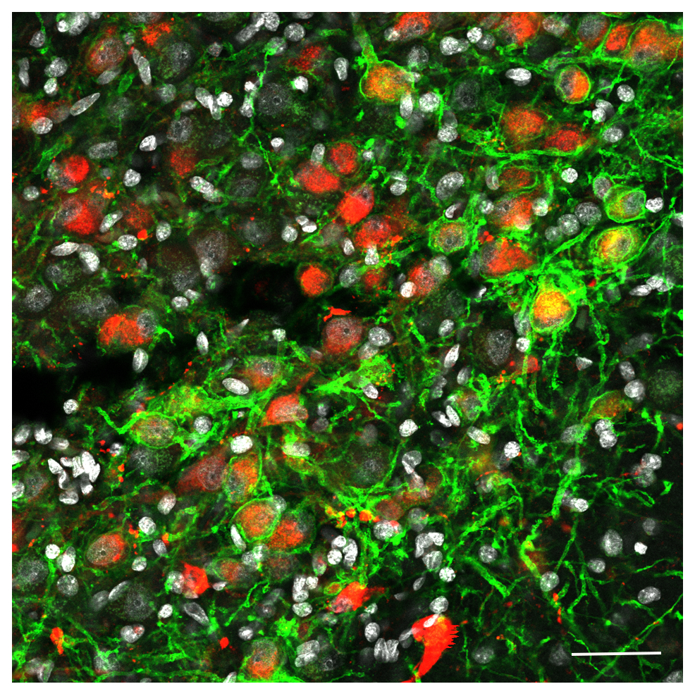 DREADD expression in oxytocin neurons