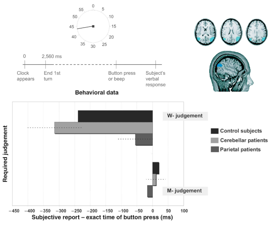 Parietal cortex and conscious timing of action