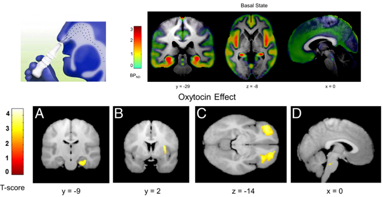 Human PET study of oxytocin effects on serotonin signalling